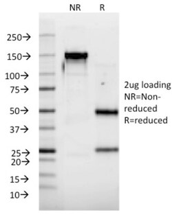 IFN-alpha 2 Antibody (N39), Novus Biologicals 0.2mg; Unlabeled:Antibodies,